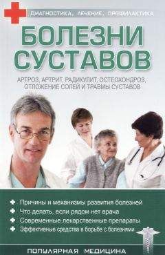 С. Трофимов (ред.) - Болезни суставов
